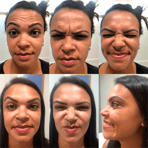LP - BOTOX 10