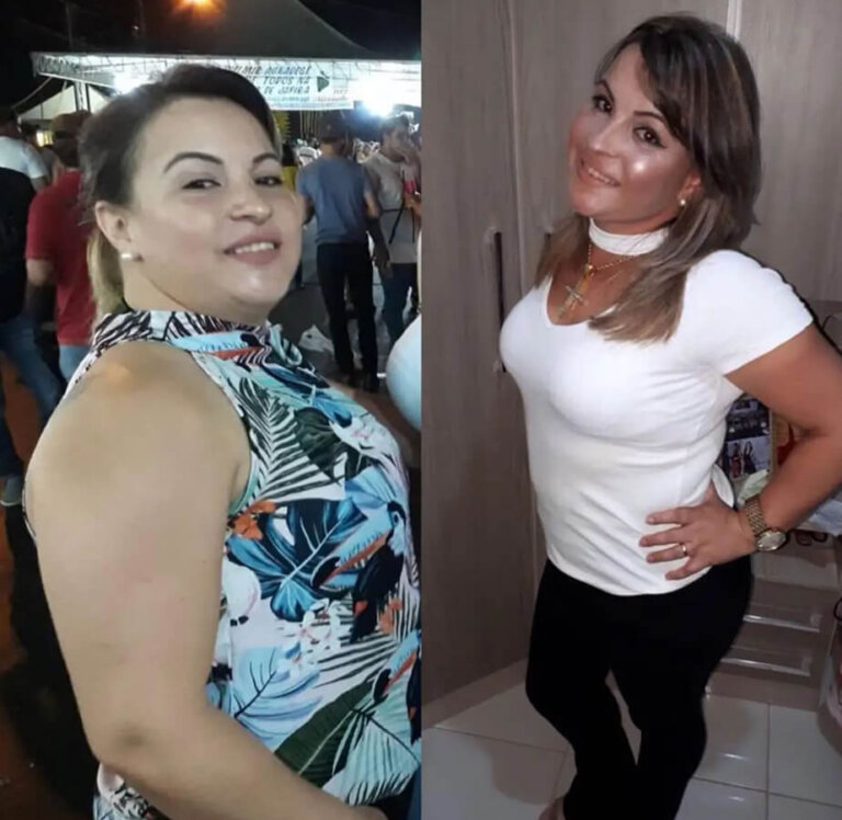 magrass_site_tirzepatida_img_antes_depois_01