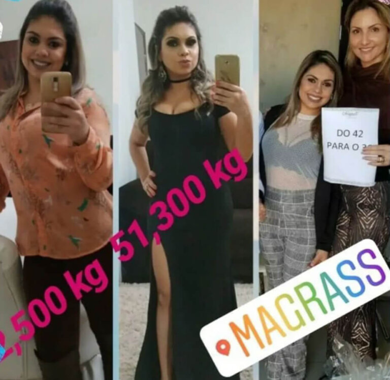 magrass_site_tirzepatida_img_antes_depois_011