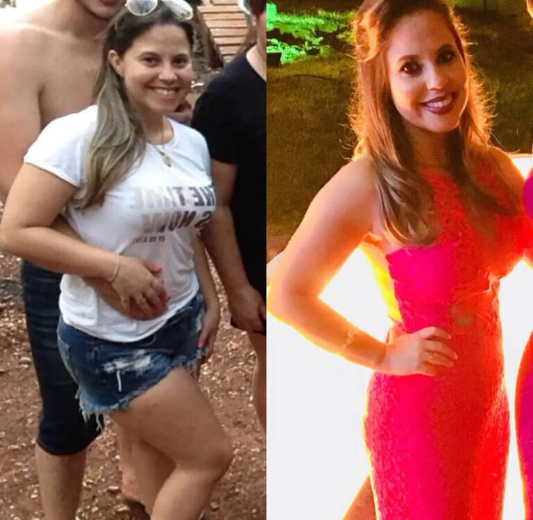 magrass_site_tirzepatida_img_antes_depois_013