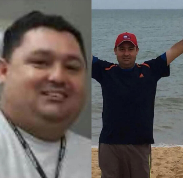 magrass_site_tirzepatida_img_antes_depois_015