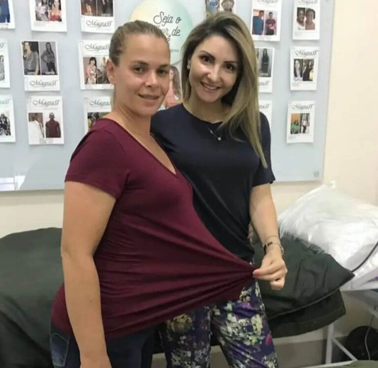 magrass_site_tirzepatida_img_antes_depois_016