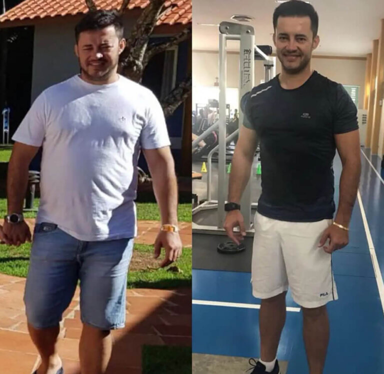 magrass_site_tirzepatida_img_antes_depois_017