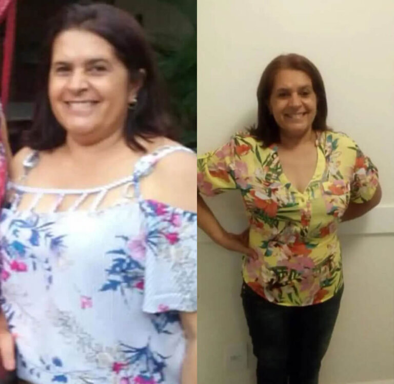 magrass_site_tirzepatida_img_antes_depois_018