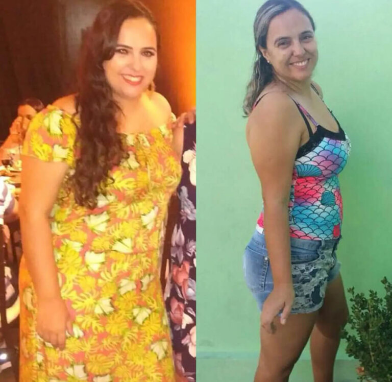 magrass_site_tirzepatida_img_antes_depois_019