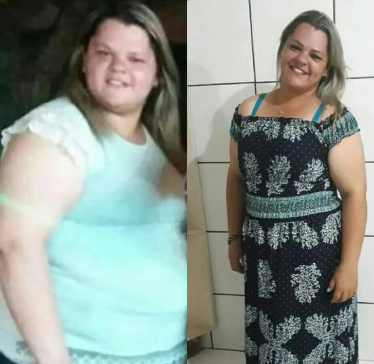 magrass_site_tirzepatida_img_antes_depois_02