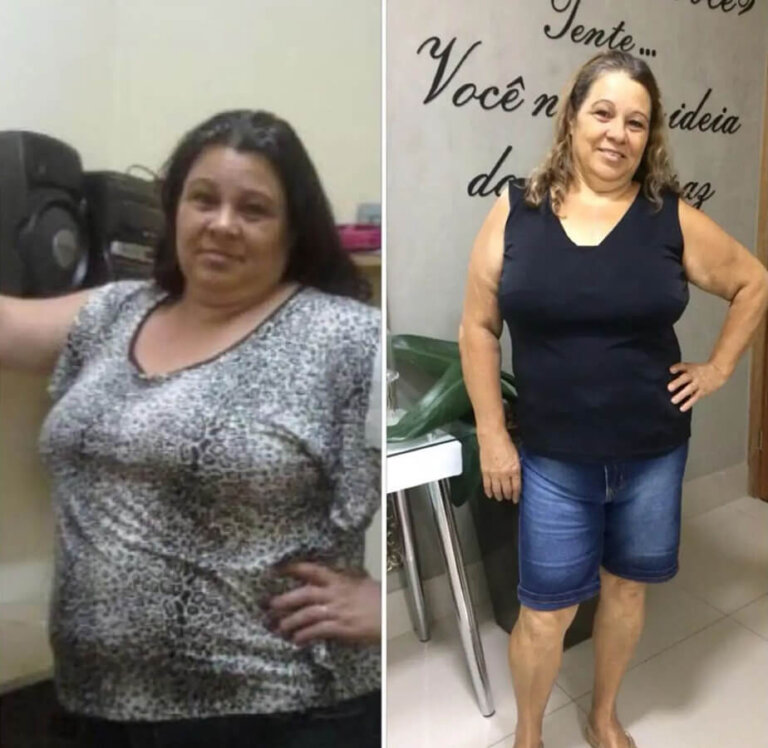 magrass_site_tirzepatida_img_antes_depois_021