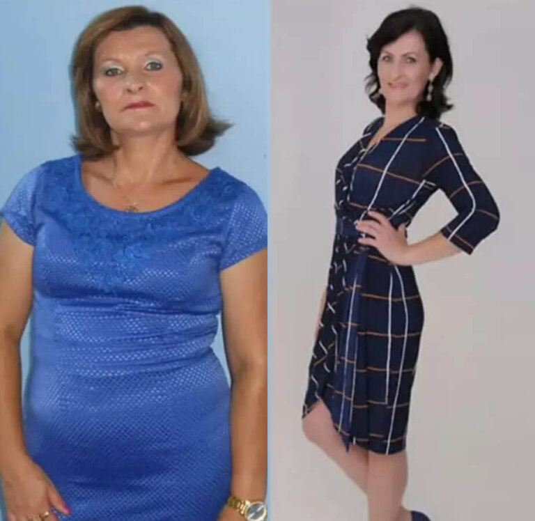 magrass_site_tirzepatida_img_antes_depois_03