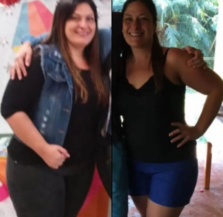 magrass_site_tirzepatida_img_antes_depois_05