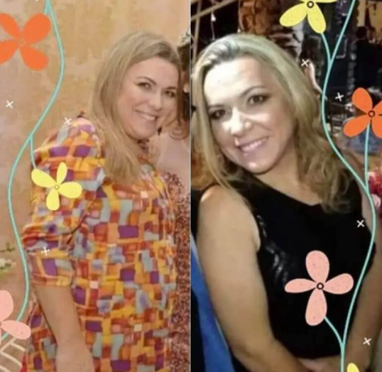 magrass_site_tirzepatida_img_antes_depois_06