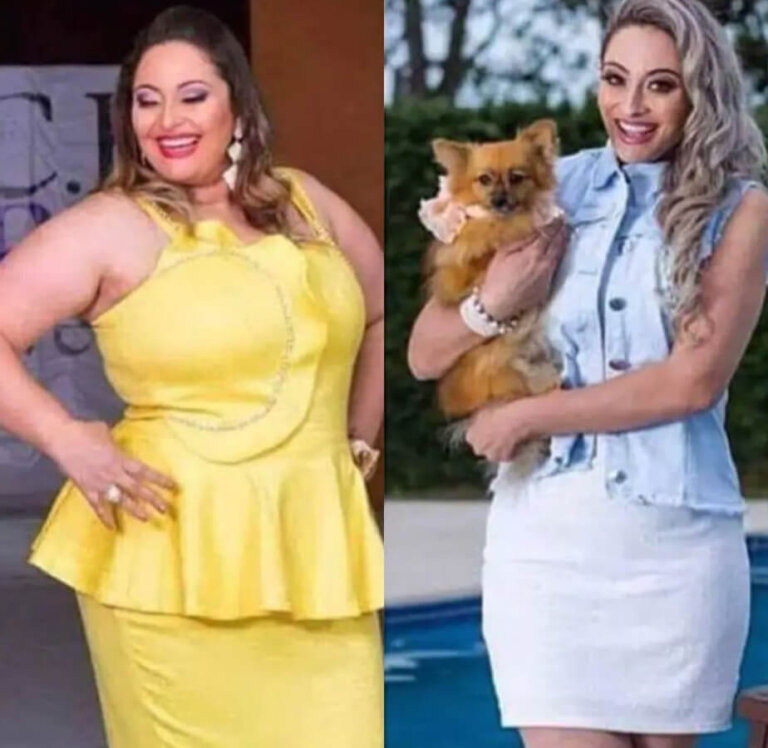 magrass_site_tirzepatida_img_antes_depois_07