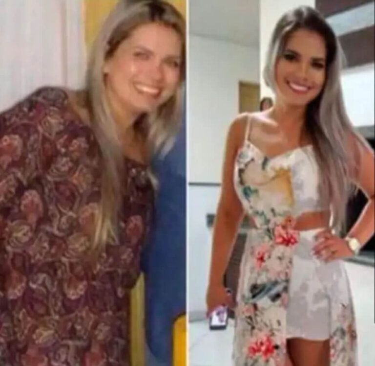 magrass_site_tirzepatida_img_antes_depois_08