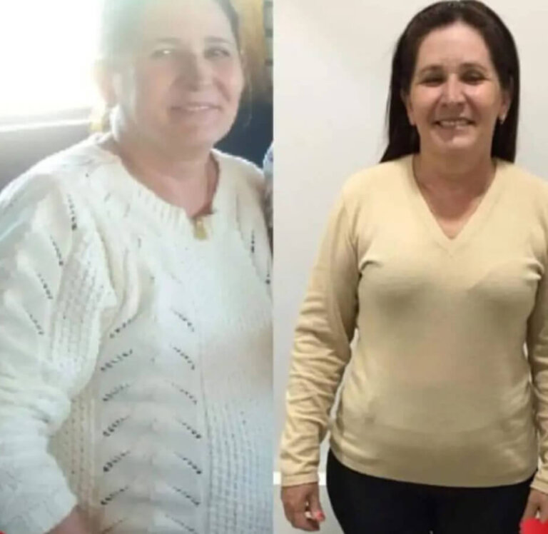 magrass_site_tirzepatida_img_antes_depois_09